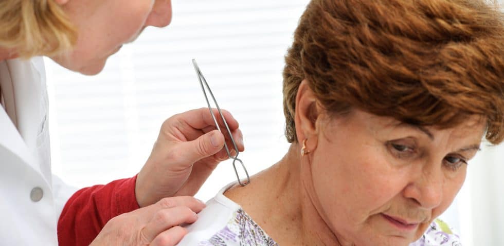 A doctor removes a tick from a woman's neck who is suffering from fibromyalgia symptoms